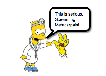 Metacarpal-Fractures