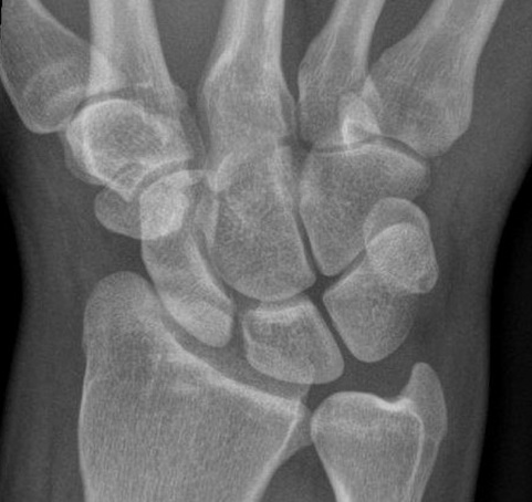 13387fbe-4744-466c-a808-bed5ebc70a2f