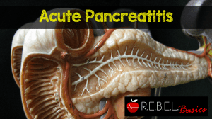 Acute-Pancreatitis-300x168