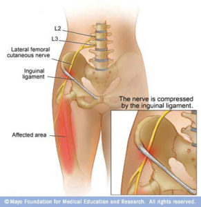 anatomy_lat_cut_fem_nerve-291x300
