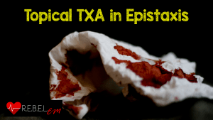 Topical-TXA-in-Epistaxis-300x169