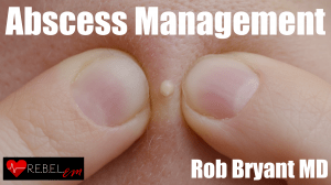 Abscess-Management-300x168.png