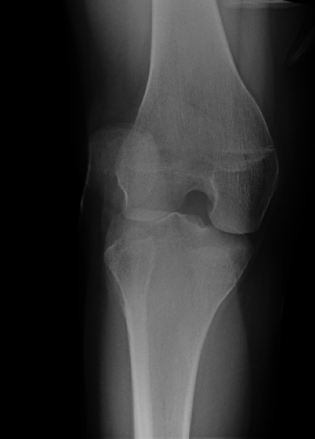 patelladislo_0.jpg