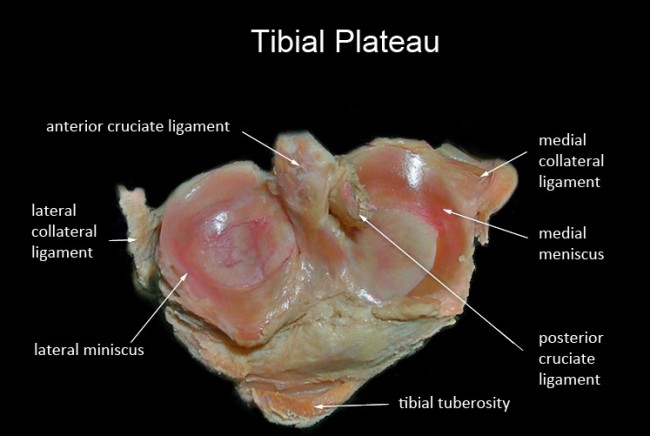 Tib-Plateau-Anatomy-650x436.jpg