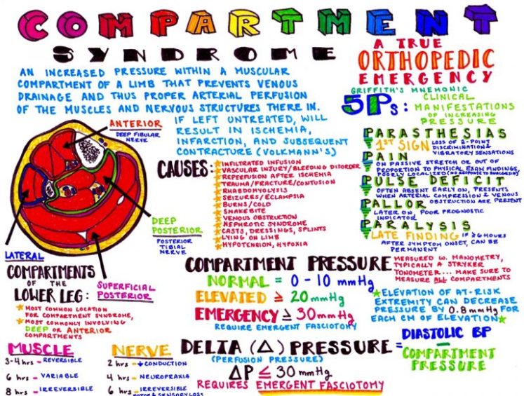 CompartmentSyndrome-768x581