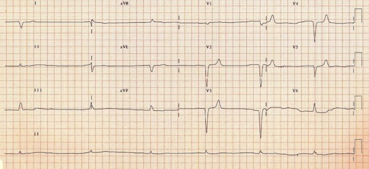 Deadly-ECG-001-1024x469.jpg