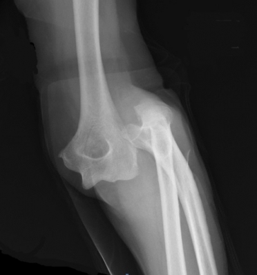 elbow2_0-372x398.jpg