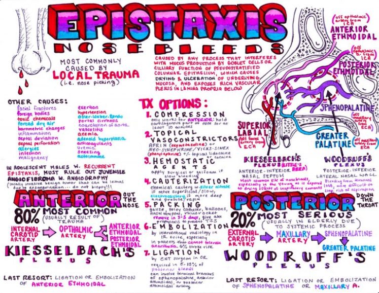 Epistaxis-768x594.jpg