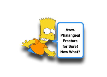 Finger-Fracture.png