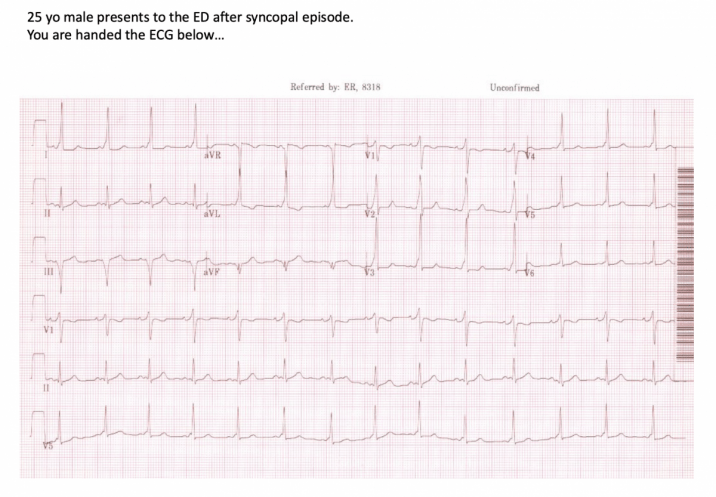 Screen Shot 2020-02-25 at 6.14.19 PM-716x497.png